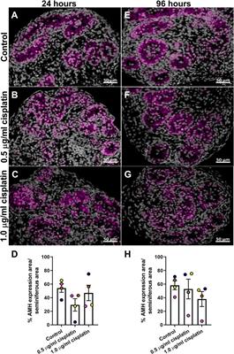 Maintenance of Sertoli Cell Number and Function in Immature Human Testicular Tissues Exposed to Platinum-Based Chemotherapy—Implications for Fertility Restoration